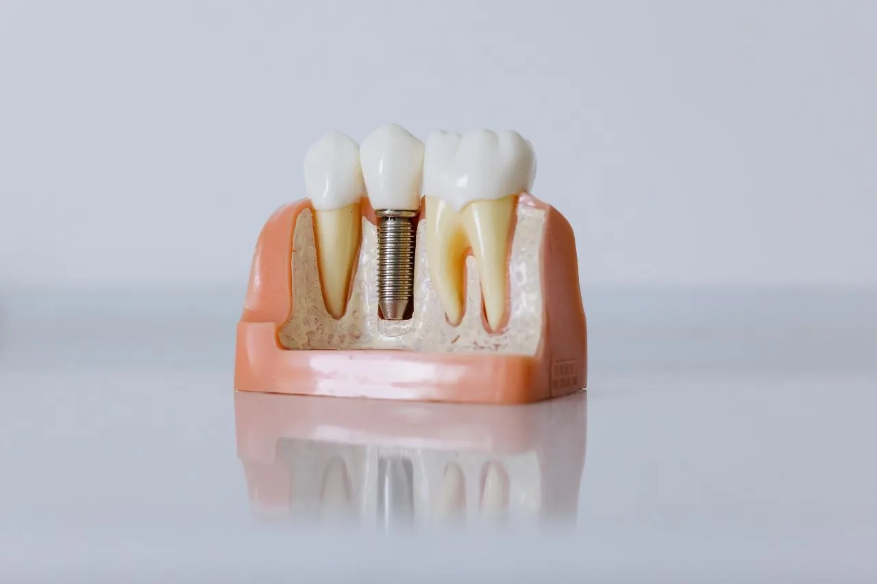 various crowns
