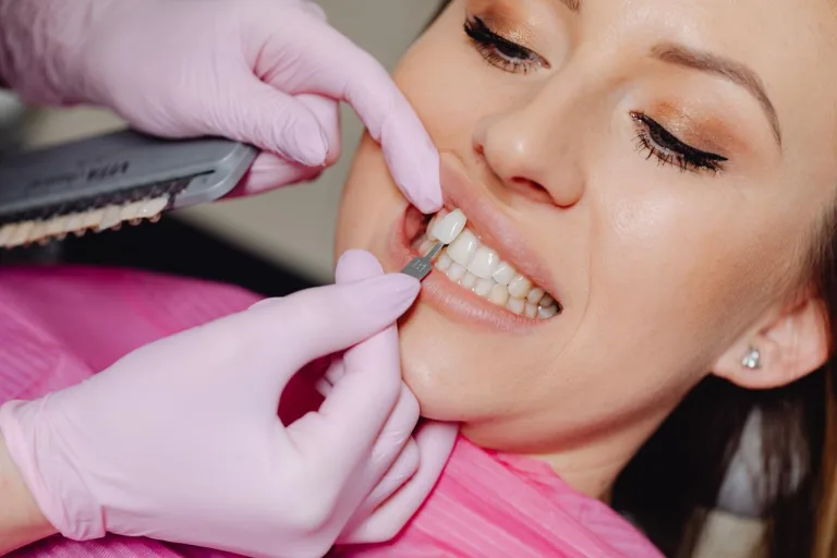Veneers: testing the shade of compared to patients teeth
