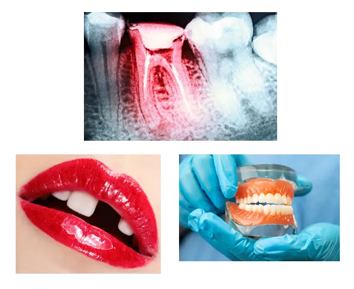 We help you avoid tooth loss and gum disease