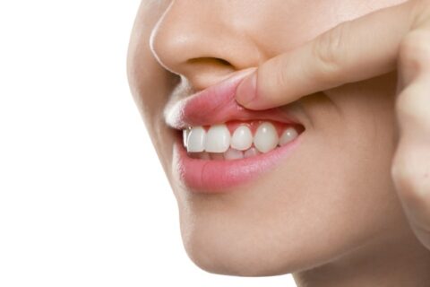 healthy gums