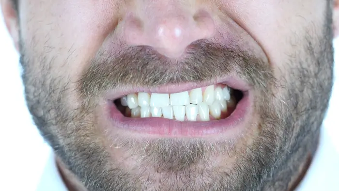 Man grinding teeth and stress